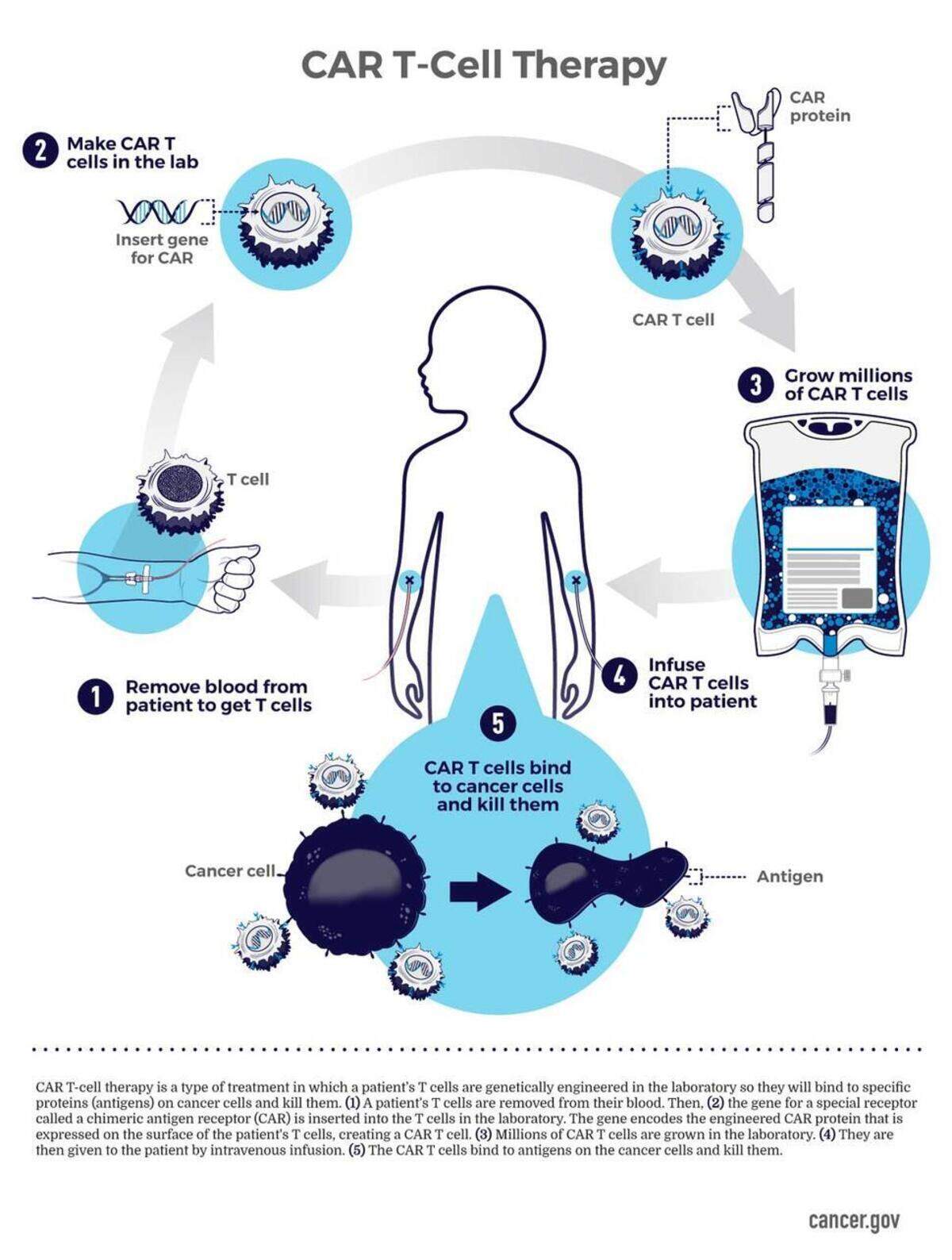 This illustration from the National Cancer Institute shows how CAR-T cell therapies work.