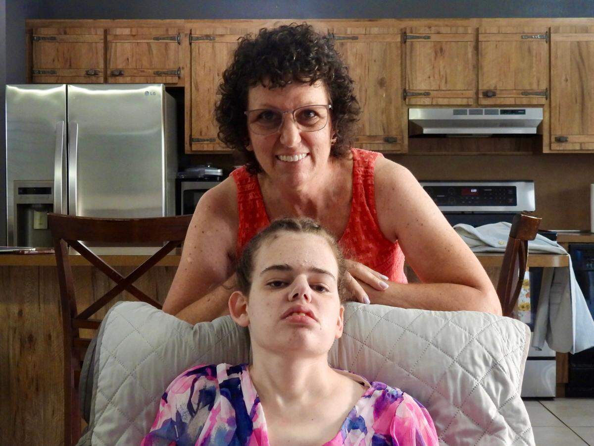 Alexa Mitchell and her mother, Toni Mitchell, at the group home in Miramar.