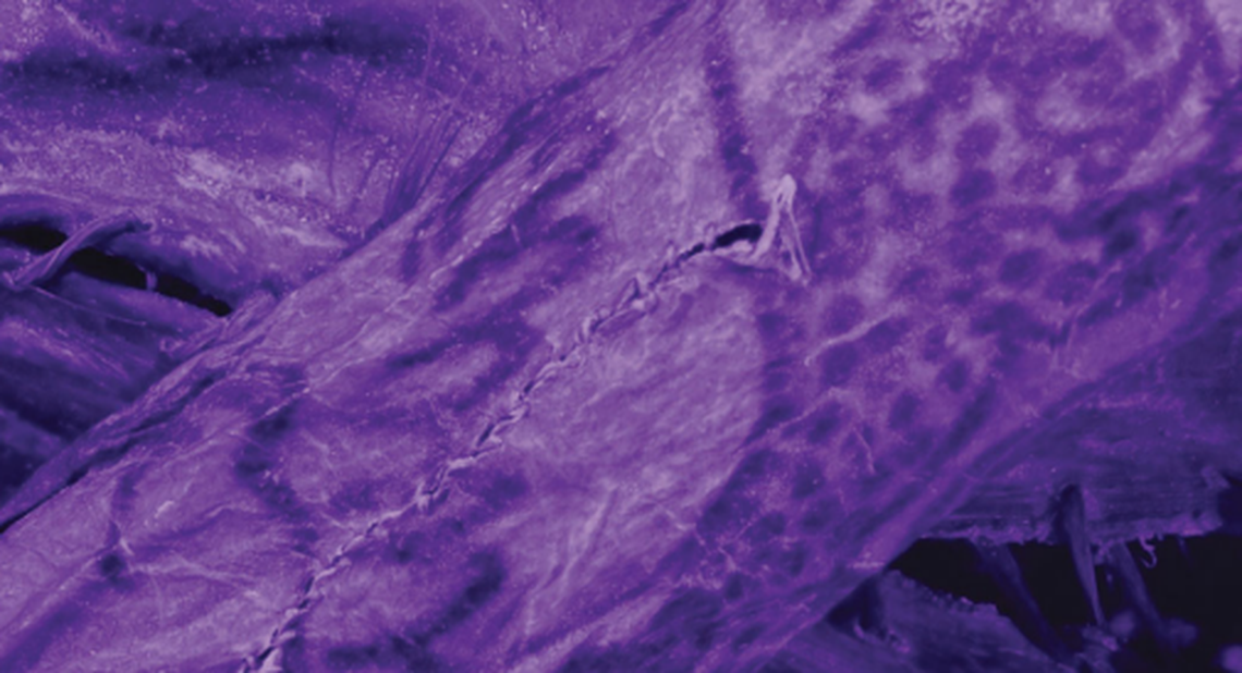 The new scans revealed more intricate details about the ancient tattoos.