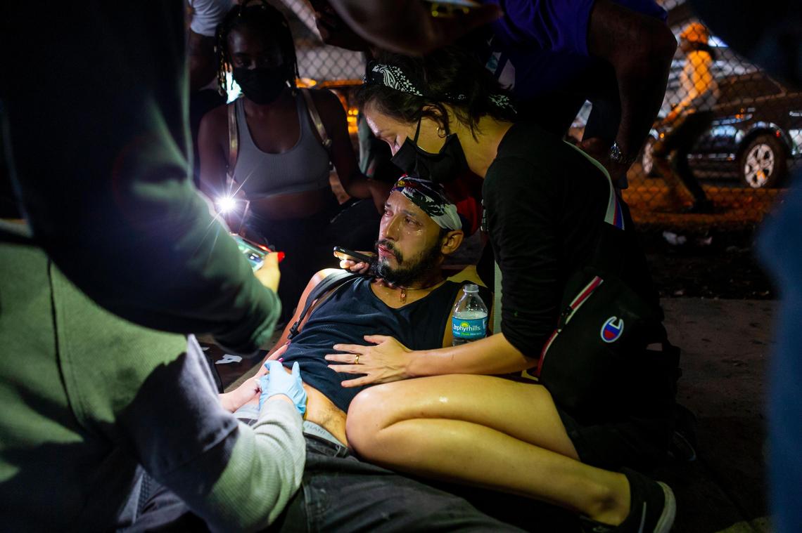 An activist is wounded during a ÒJustice for George FloydÓ protest in downtown Miami on Saturday, May 30, 2020.