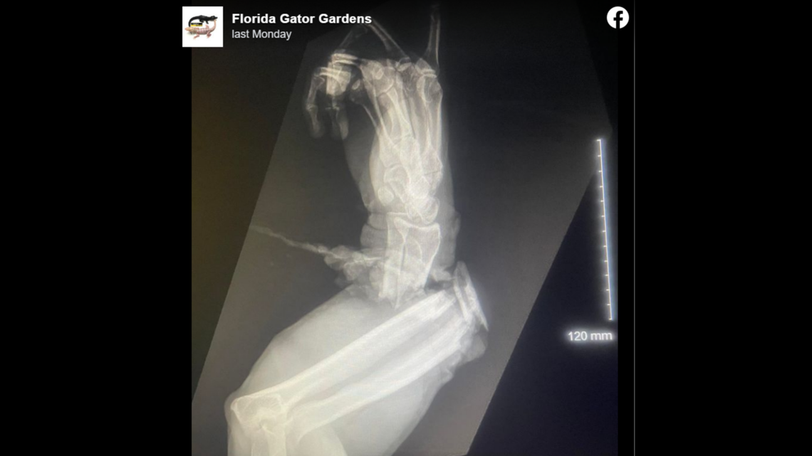 An alligator crushed the lower arm of the director of wildlife at Florida Gator Gardens.