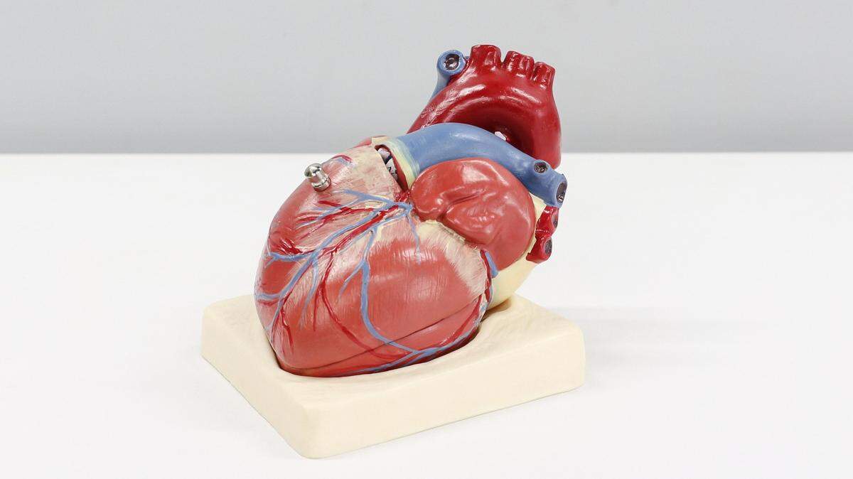 Long COVID and heart issues: Doctors and a patient weigh in on lingering heart symptoms after a COVID-19 infection.