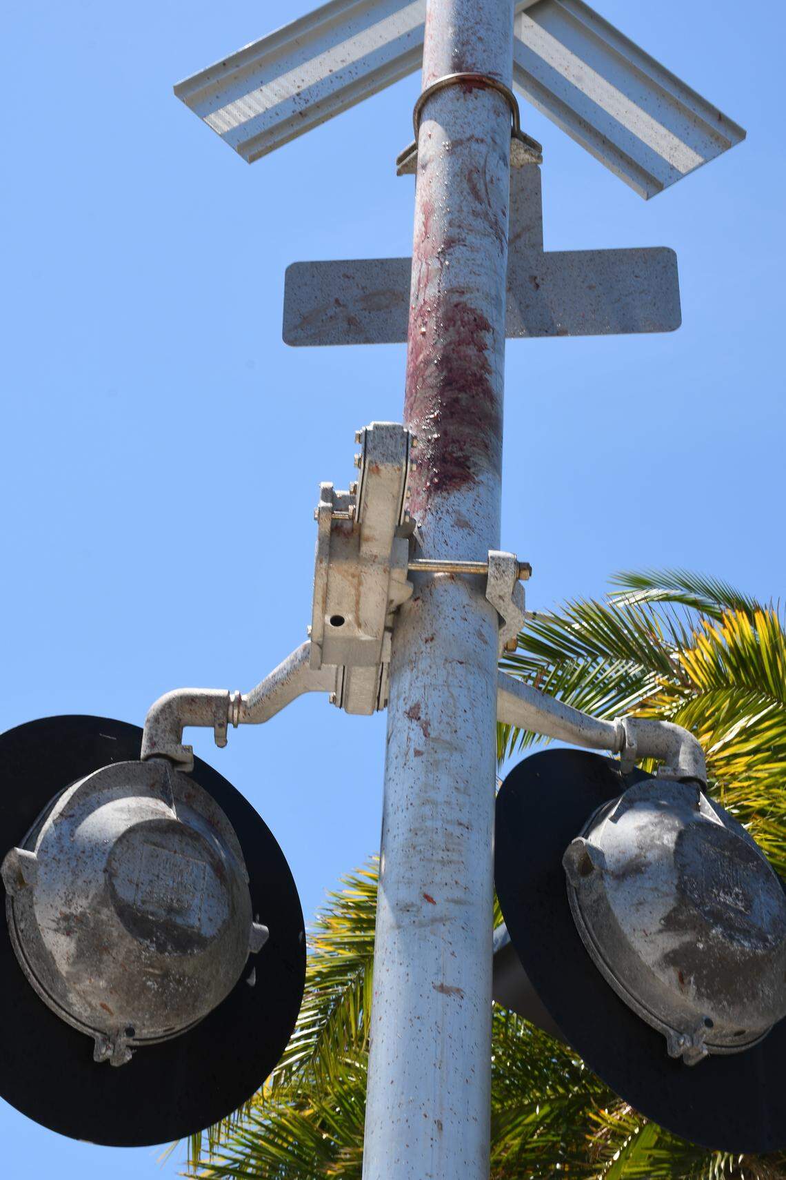 A Brightline train traveling at 102 mph hit a man walking across the tracks in Brevard County in the spring of 2024, sending his body into a flashing signal pole.