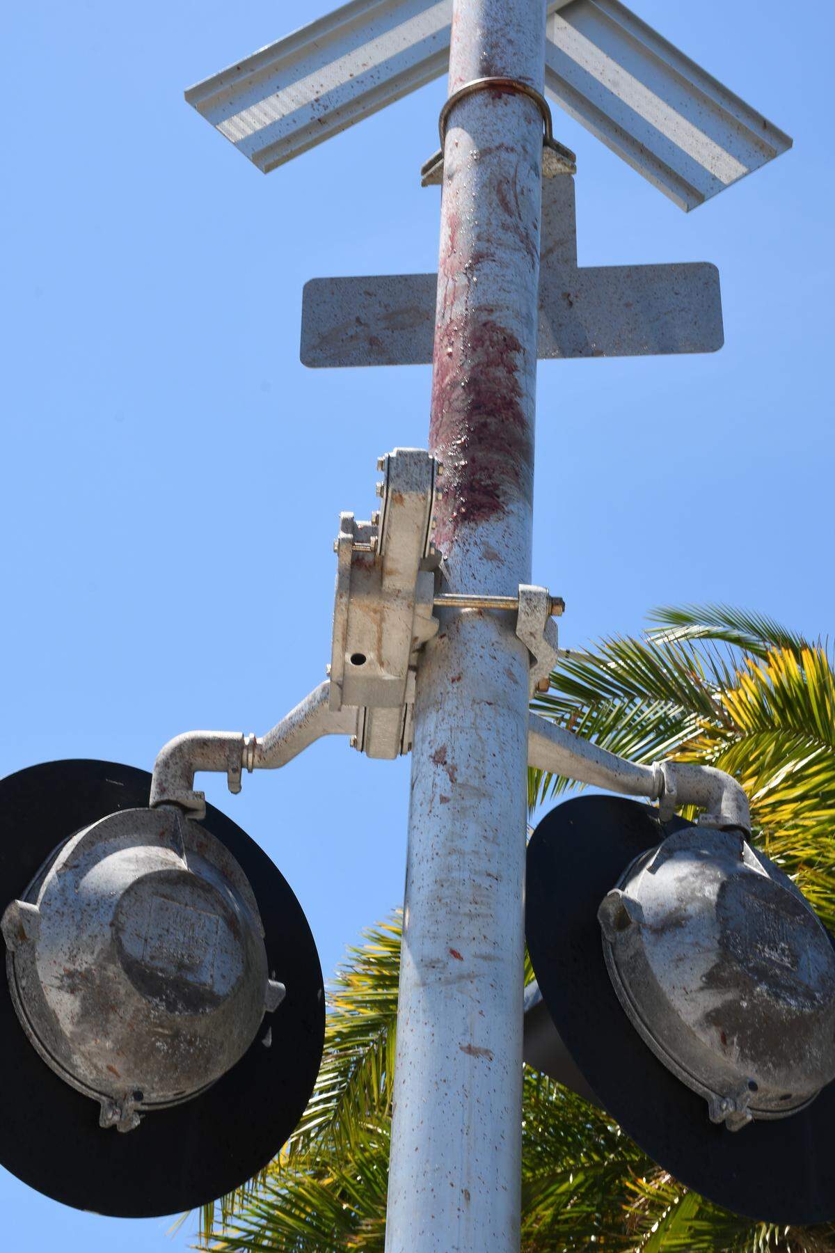 A Brightline train traveling at 102 mph hit a man walking across the tracks in Brevard County in the spring of 2024, sending his body into a flashing signal pole.