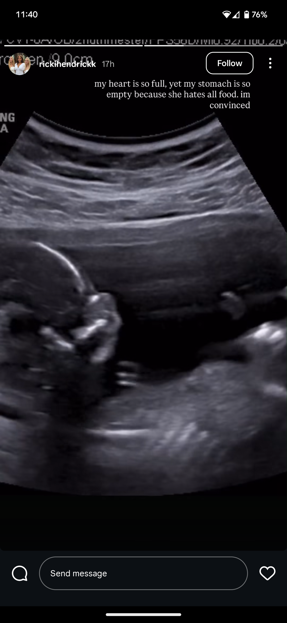 ricki hendrick pregnancy reveal ultrasound photo