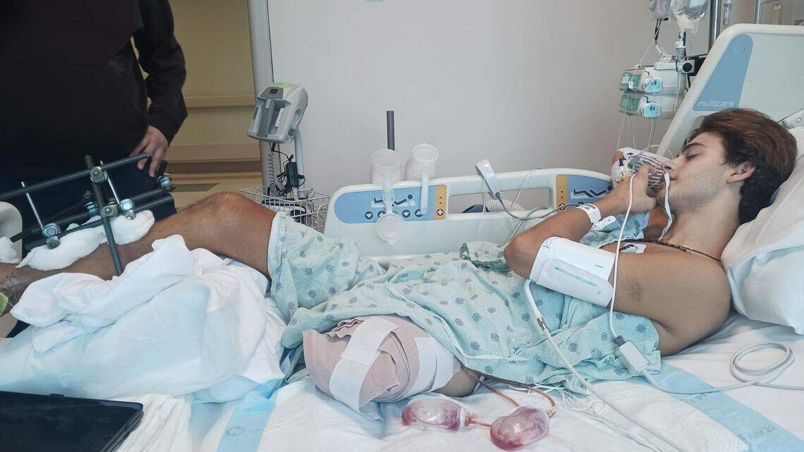 ‘Survivor Greece’ star who lost a leg sues producers in Miami-Dade court