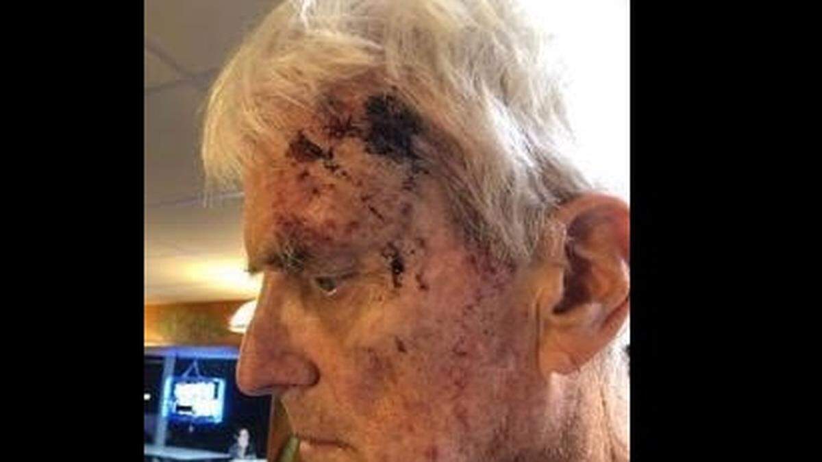 Robert Smith, from Key Largo, shows wounds he said he suffered when he was attacked by a man Tuesday, May 14, who told him to stop feeding a feral cat colony near mile marker 101.