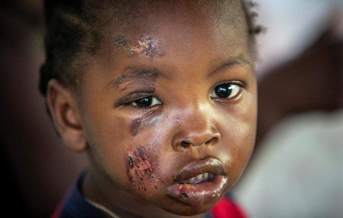 Les Cayes, Haiti, August 16 2021 -