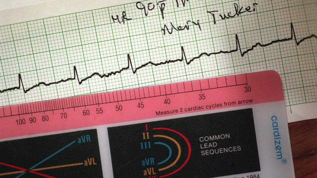 An EKG records the electrical activity of the heart. It checks for signs of heart disease, and is used to detect heart attacks, arrhythmias (irregular heartbeats) and heart failure. Many doctors say student athletes should be tested with an EKG to determine whether they are at risk for sudden cardiac arrest before they play. Many schools do not require the test as part of a student athlete’s physical.