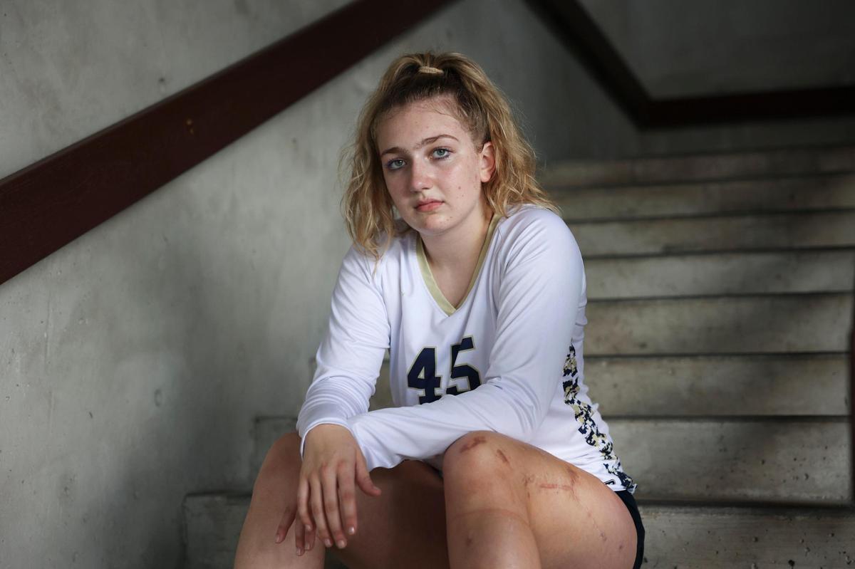 Deven Gonzalez, senior volleyball player for Miami High who suffered injuries to her left leg in the Surfside collapse, poses for a portrait between matches on Tuesday, Oct. 4, 2022, at Miami Dade College campus in Kendall. Gonzalez lost her father in the collapse as well. “[Playing volleyball] was just another loss that I was not going to allow her to experience, not right now anyway,” said her mother, Angela.
