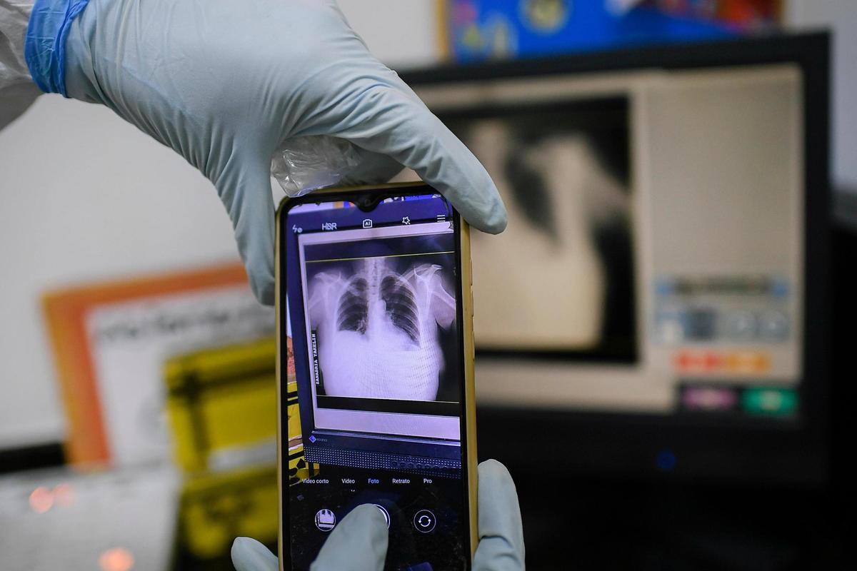 A health worker takes a photo of a COVID-19 patient’s chest X-rays with her mobile phone, at the Ana Francisca Pérez de León II public Hospital in Caracas, Venezuela, on March 28, 2021.