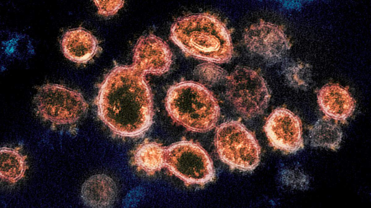 A COVID-19 infection offers strong but temporary protection against severe disease for all variants, a study found.