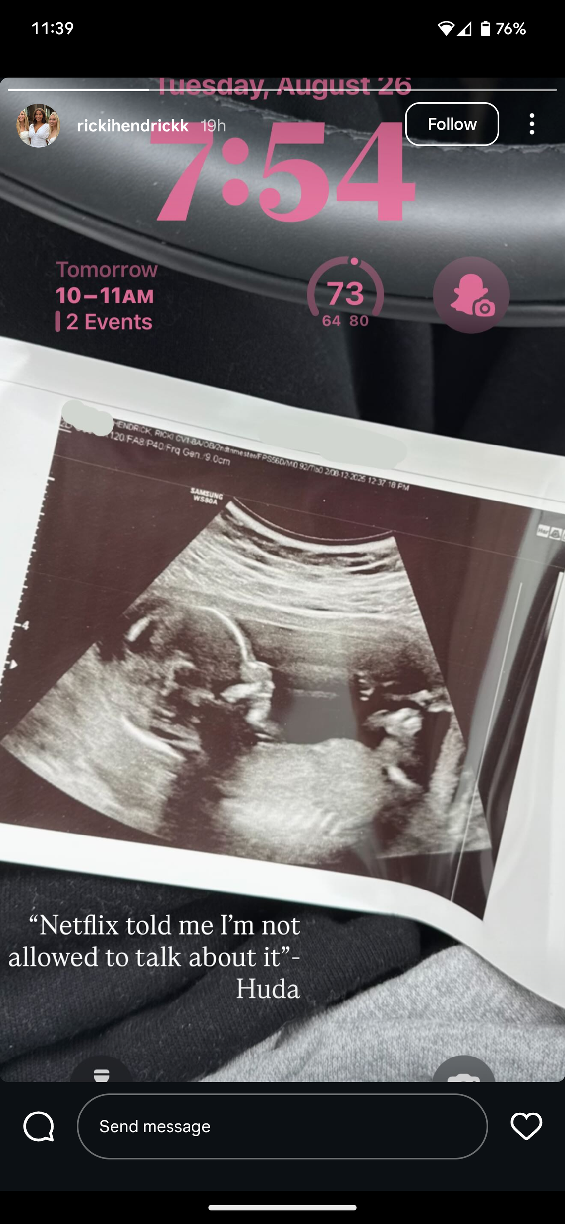 ricki hendrick pregnancy reveal ultrasound photo