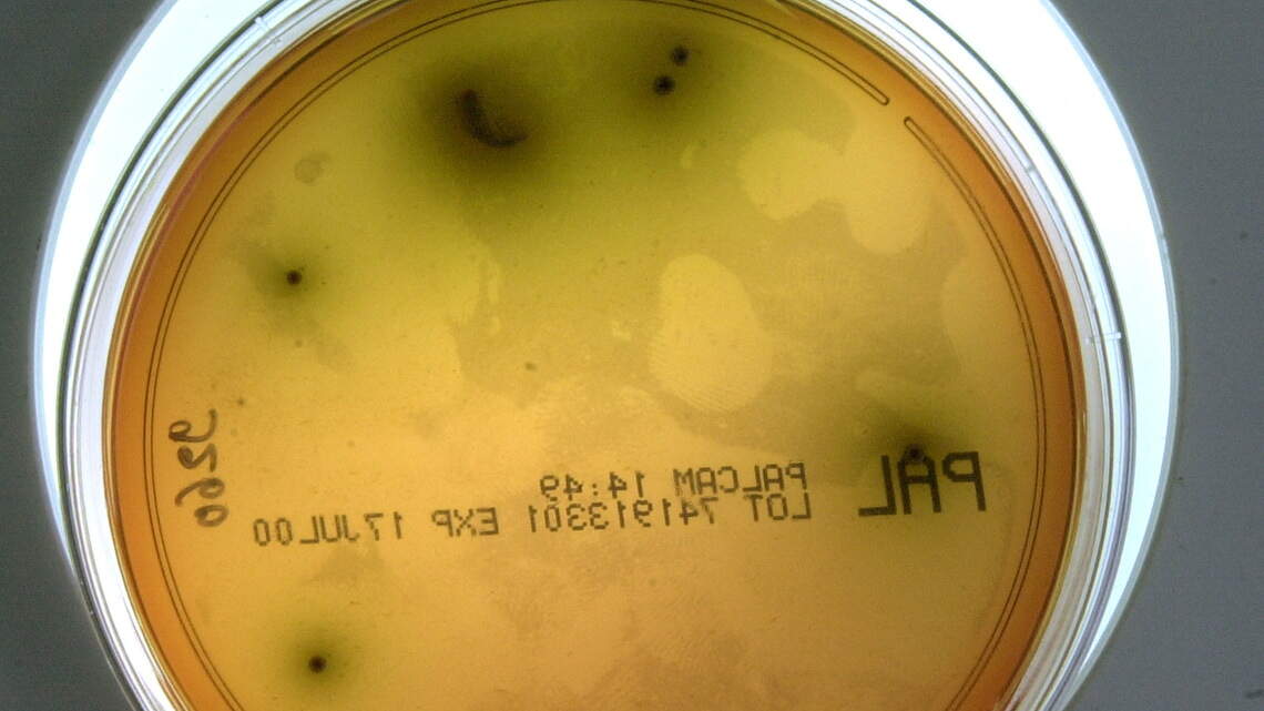 Cyclospora boosts fears that worse foodborne outbreaks are ahead