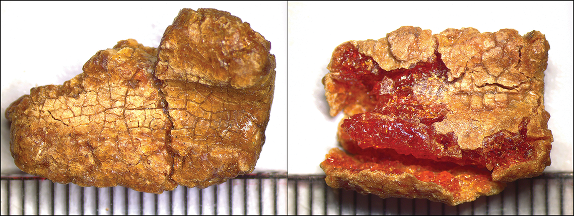 The chemical signature matched amber from the Baltics, meaning it traveled thousands of miles to arrive in Hama, researchers said.