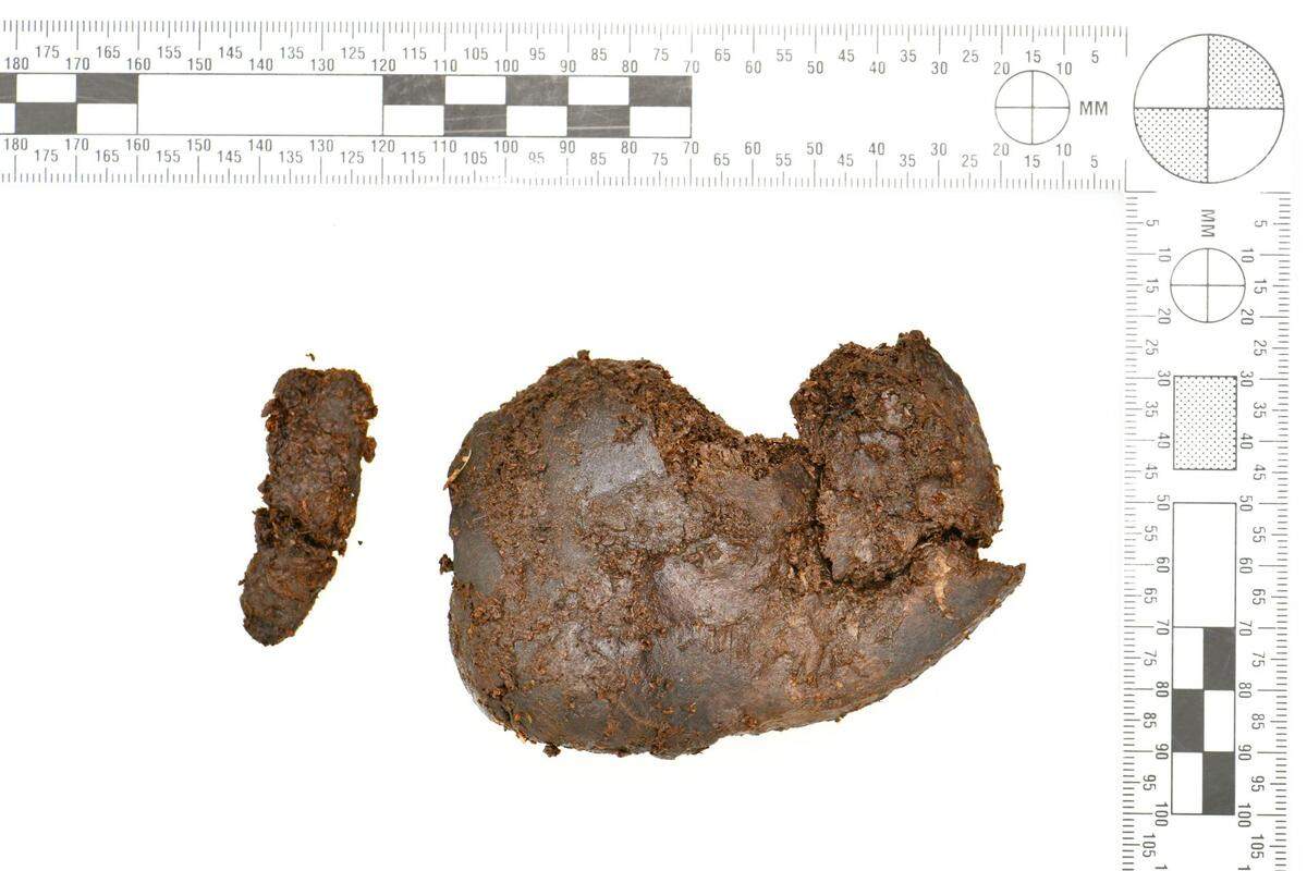 Experts discovered what they think is the teenager’s kidney.
