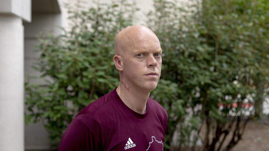 Eastern Kentucky University’s men’s basketball coach A.W. Hamilton poses for a portrait on EKU’s campus in Richmond, Ky., in August 2020. Hamilton was diagnosed with stage II melanoma in June 2020. Hamilton found out about his cancer because his assistant coach and brother-in-law Steve Lepore, suffered a sudden stroke, causing him to re-evaluate his health and visit his doctor.