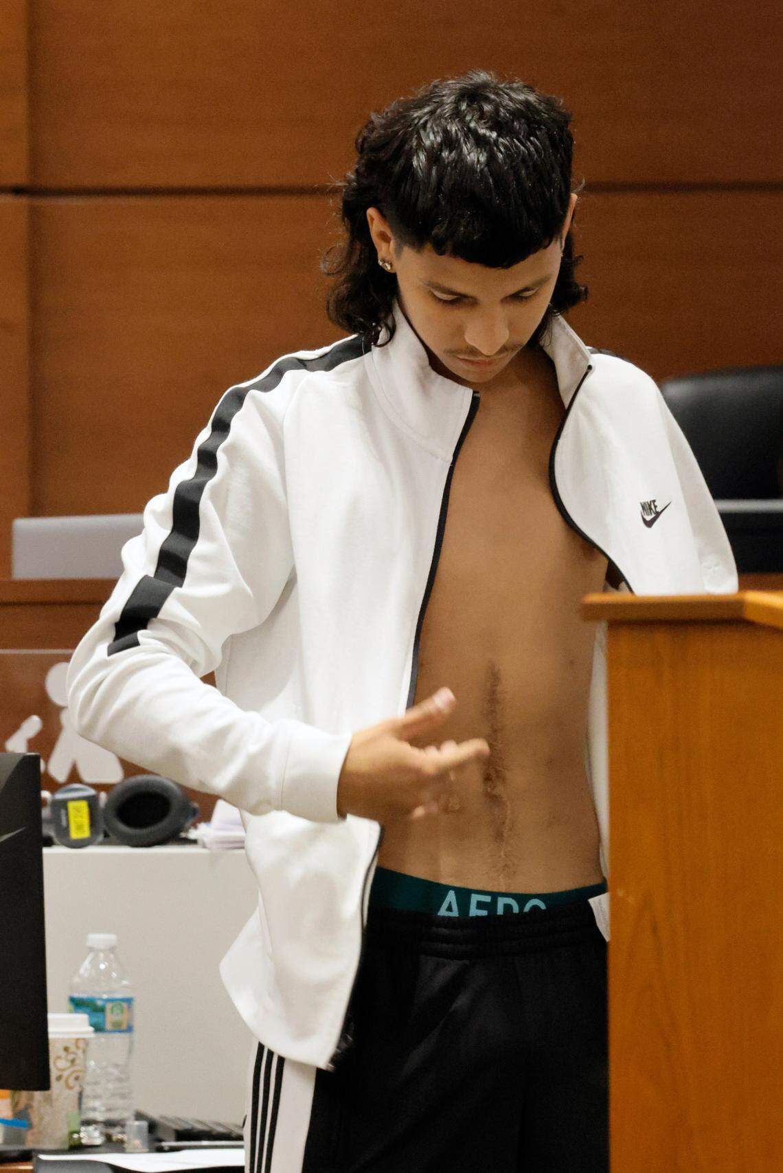 Former Marjory Stoneman Douglas High School student Anthony Borges shows his gunshot wounds to the jury. He was shot five times.