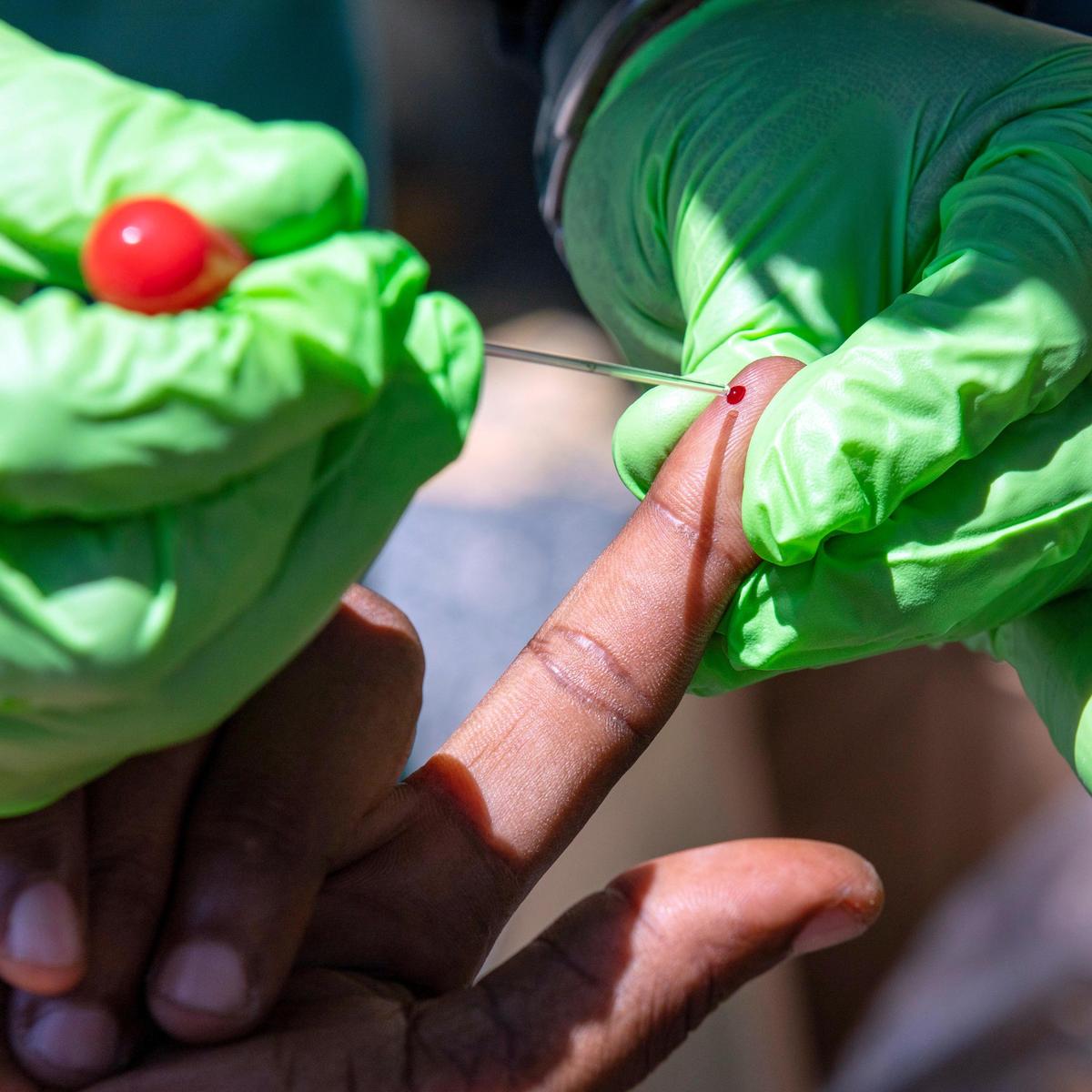 John Layals, a homeless man in Miami, has his blood drawn for a rapid antibody COVID-19 test at St. John Institutional Missionary Baptist Church in Overtown on Friday. A group of community volunteers is administering the tests.