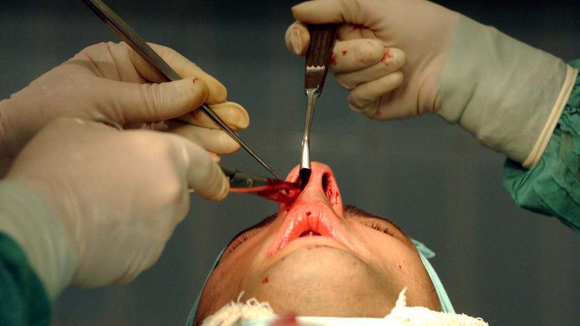 If you are thinking of having a rhinoplasty, or nose surgery, ask the surgeon if she or he can provide you with an image of what your new nose would look like.