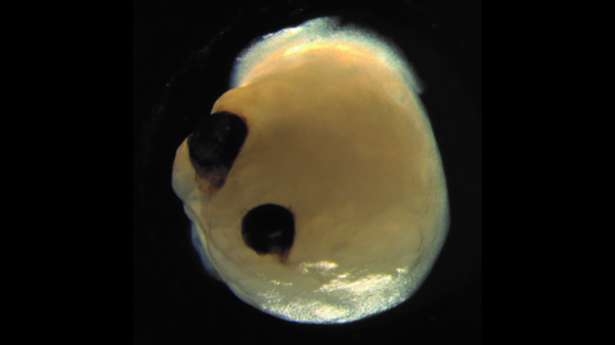 This image shows a brain organoid with optic cups, created by a team of researchers to study retinal development.