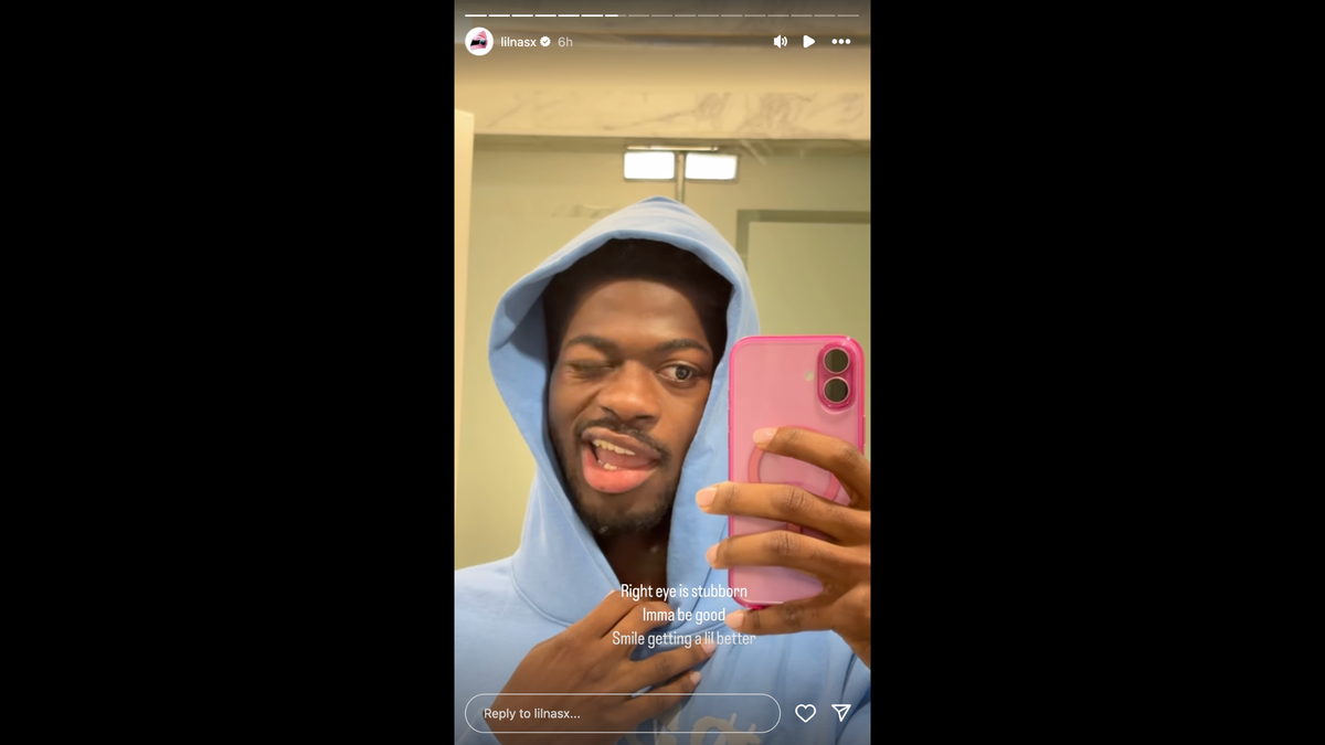 Lil Nas X reveals he’s experiencing face paralysis.