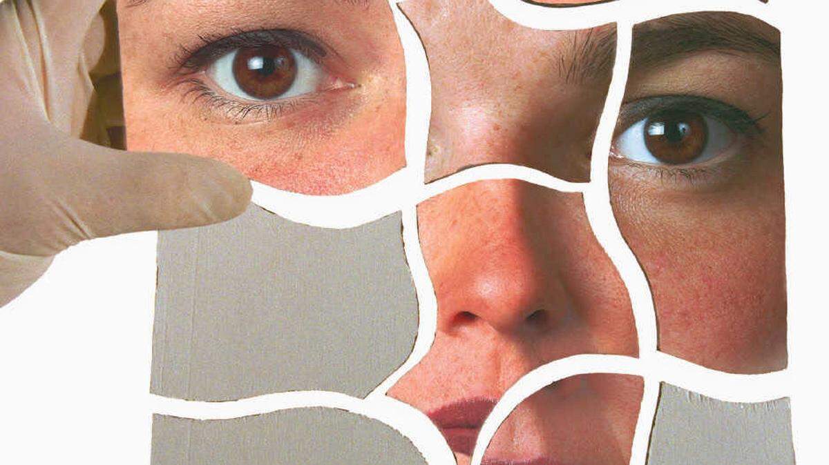 Before deciding on whether a facelift is right for you, you should consider several factors, says Dr. Carlos Wolf.