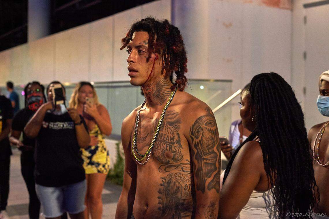 Protesters said a second person was shot in the head with a foam baton.