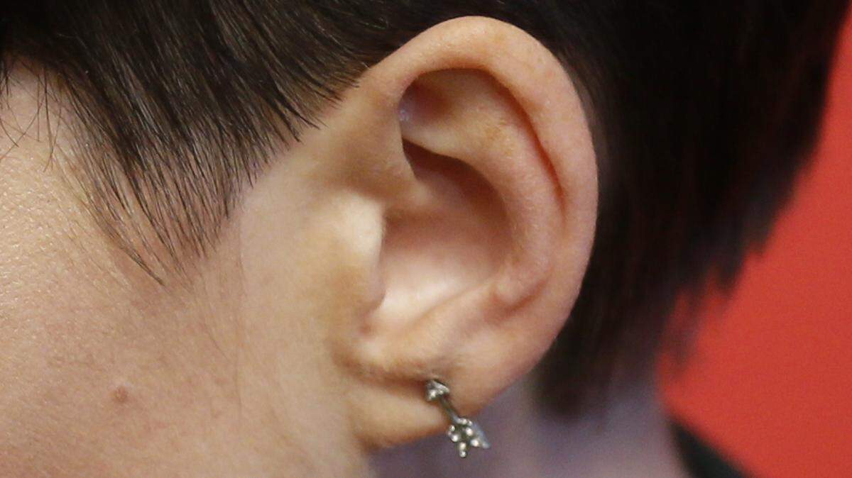 Could COVID-19 vaccines cause hearing loss and tinnitus? The WHO reported potential cases and said it needs more investigation. Here’s what health experts say.
