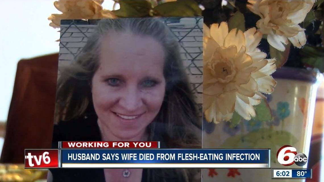 Carol Martin, a 50-year-old woman from Indianapolis died after doctors told her husband his wife contracted necrotizing fasciitis, commonly called "flesh-eating bacteria," after they returned home from a Florida vacation in February. She died May 5, 2018. This is a screen grab from a WRTV ABC 6 news report.
