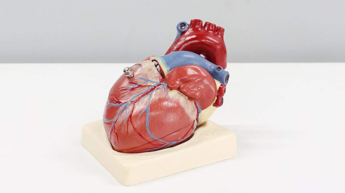 The risk of the developing the heart condition POTS is higher after a COVID-19 infection, a study found.