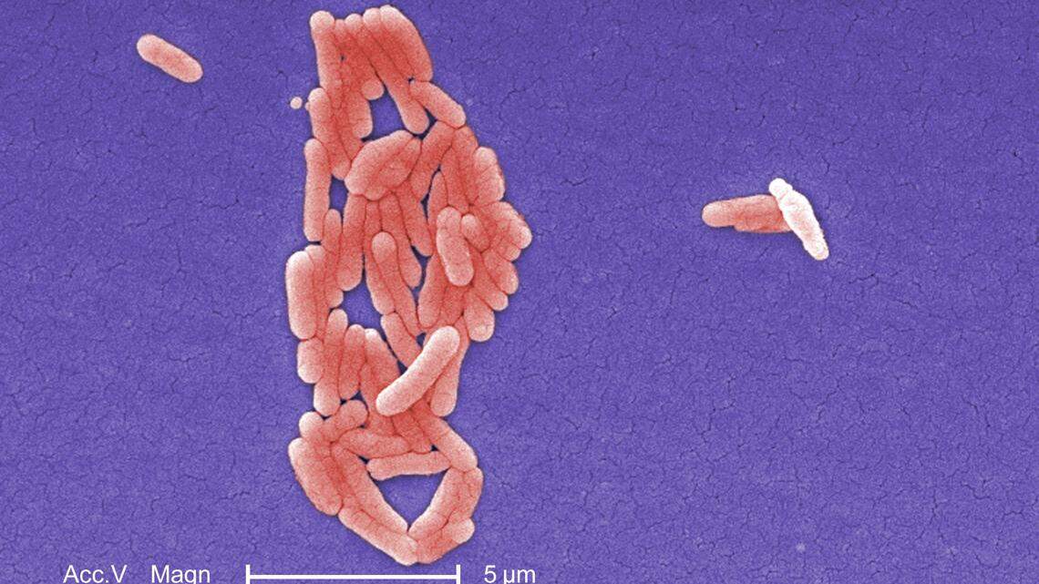 This 2008 file photograph provided by the Centers for Disease Control and Prevention, under a magnification of 5000X, shows clustered Gram-negative Salmonella Typhimurium bacteria.