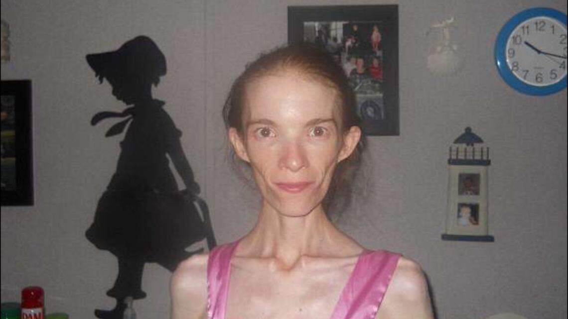 She’s starving to death — and public health agencies can’t or won’t stop it