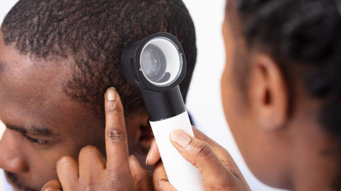The same condition that causes dandruff -- seborrheic dermatitis --also can cause a red and itchy beard.