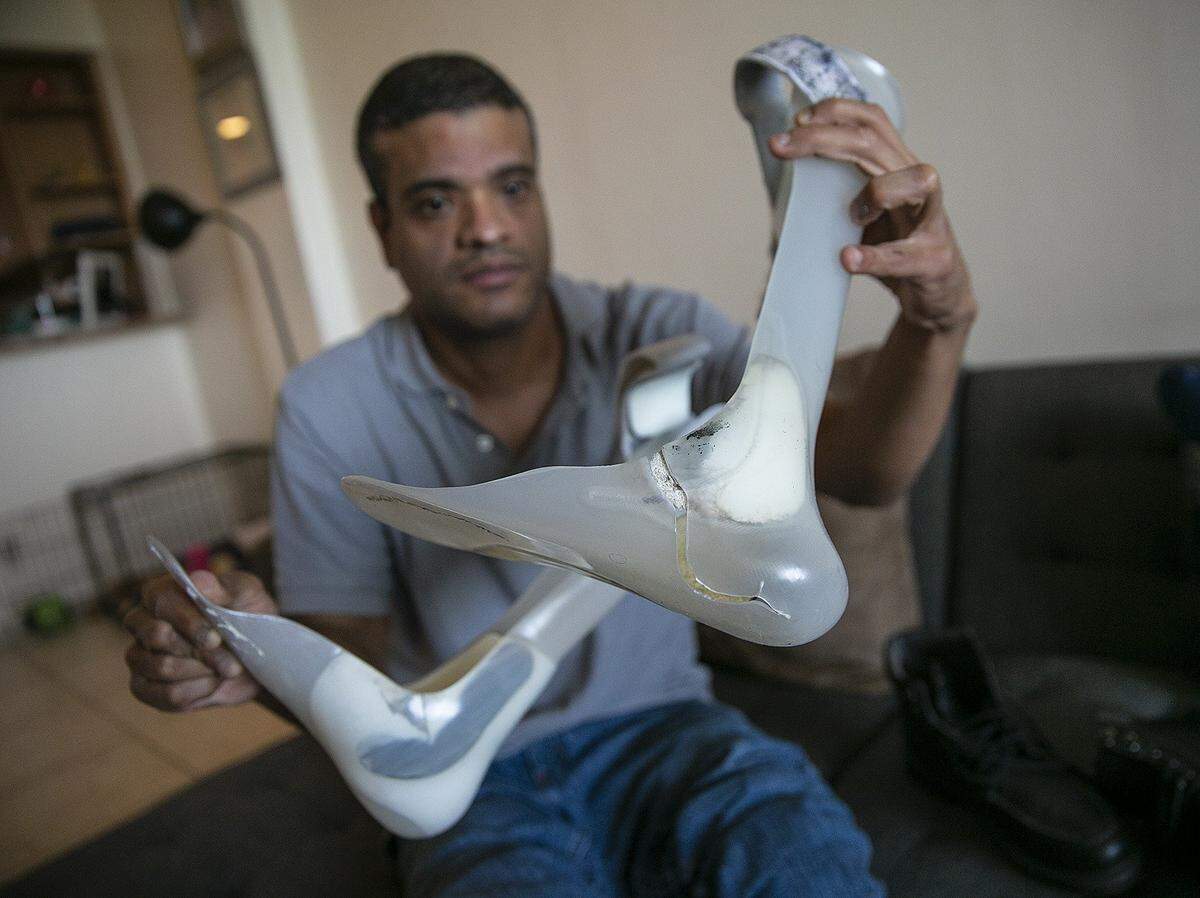Rolando Ramirez shows his broken “leg braces” that need to be replaced, as part of Wish Book. Without them, he can’t walk.