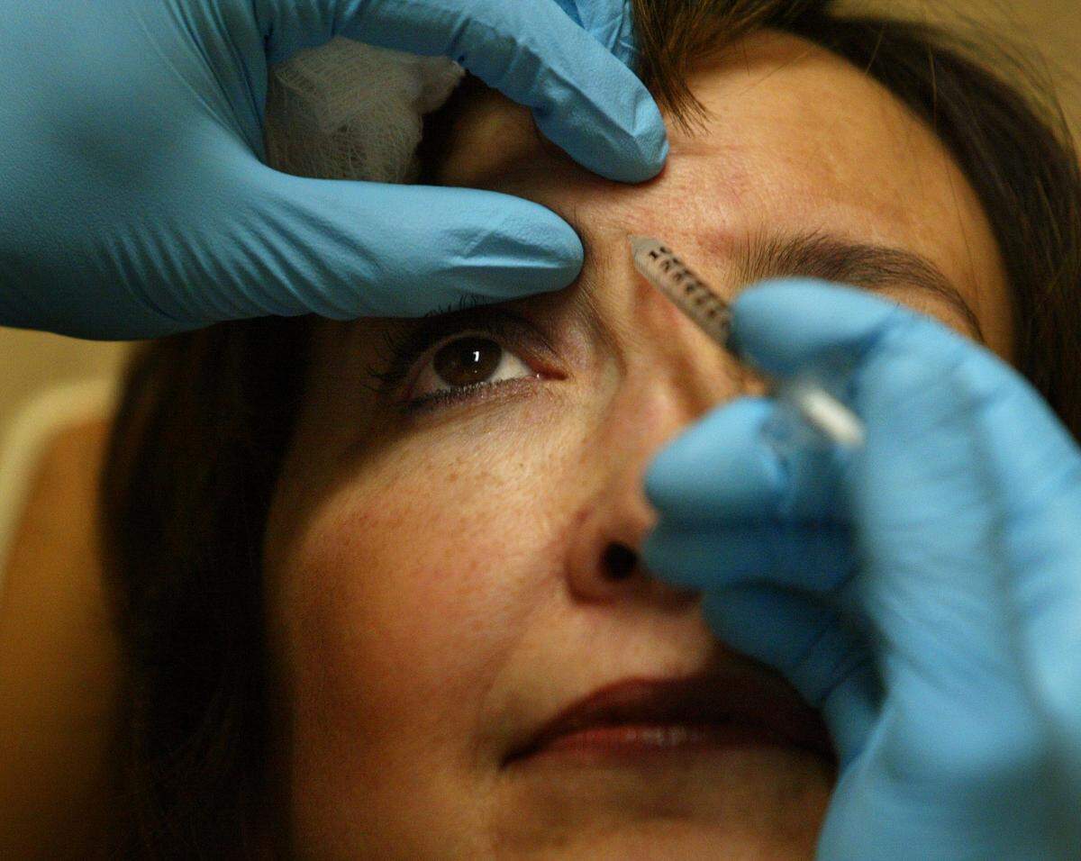 La FDA aprobó un nuevo tratamiento con neurotoxinas llamado Daxxify, que pronto estará en el mercado. Trata las arrugas del entrecejo.