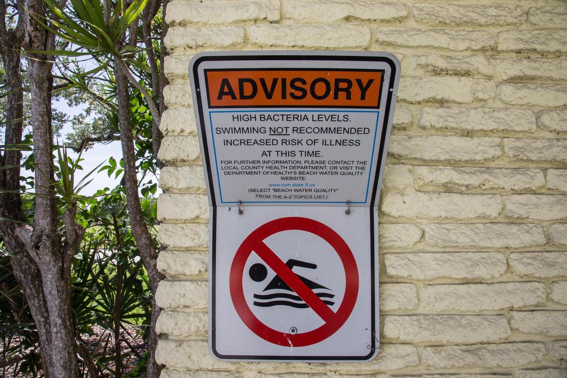 A sign warns swimmers about high bacteria levels at Crandon Beach North.