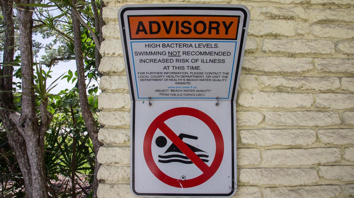 Warning signs about high bacteria levels, such as these at Crandon Beach North from 2018, are posted at five Miami-Dade beaches