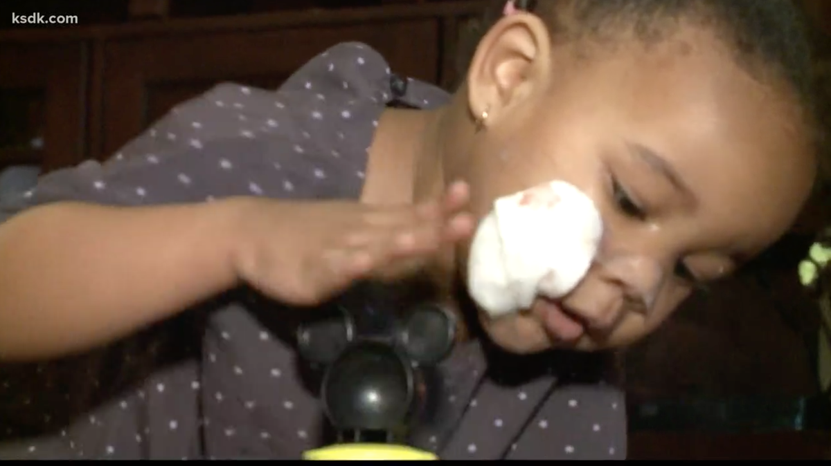 A dog bit Dionne Howard, a 2-year-old girl, in Normandy, Missouri, as her family showed up for a Christmas party at her great-grandmother’s house, police say. The dog is a pit bull or white boxer mixed breed.