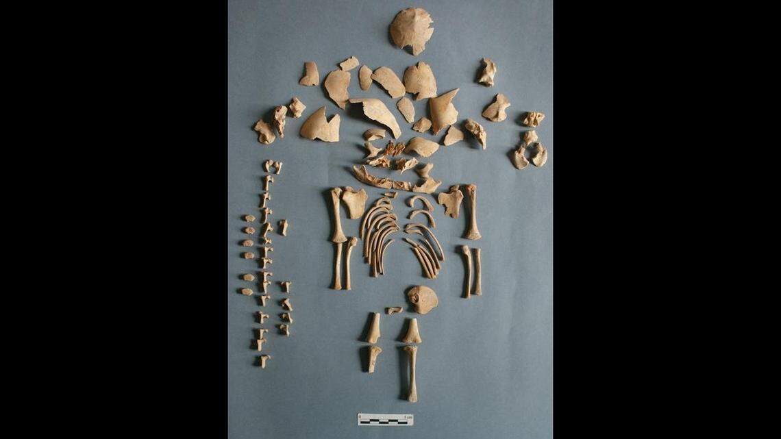 Researchers analyzed the remains of infants buried across Europe and found six cases of Down syndrome and one case of Edwards syndrome, according to the study.