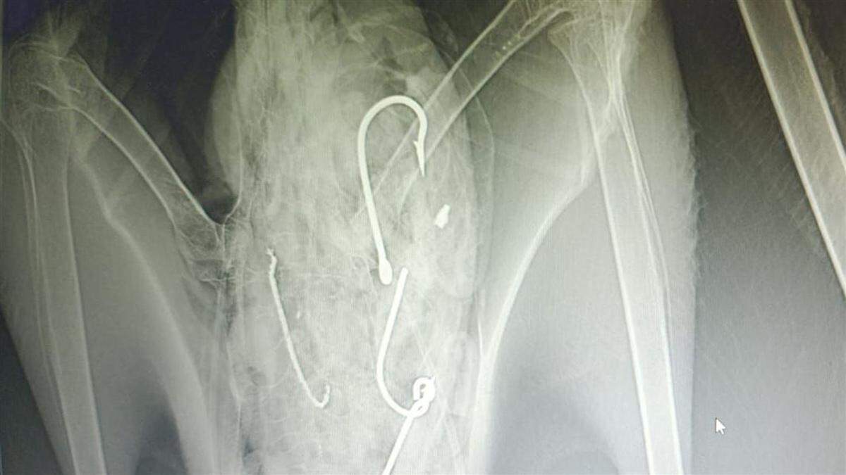 Fishing line and four hooks were found inside the young bird’s body.
