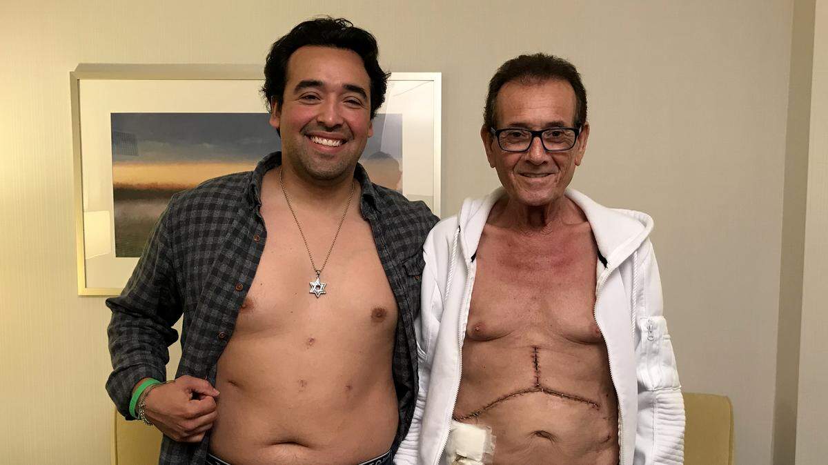 Nikko Velazquez and Abraham Aziz show off their surgery scars. Velazquez donated the left lobe of his liver to Aziz, who has non-alcoholic fatty liver disease, which is common in type 2 diabetics. Aziz has type 2 diabetes..