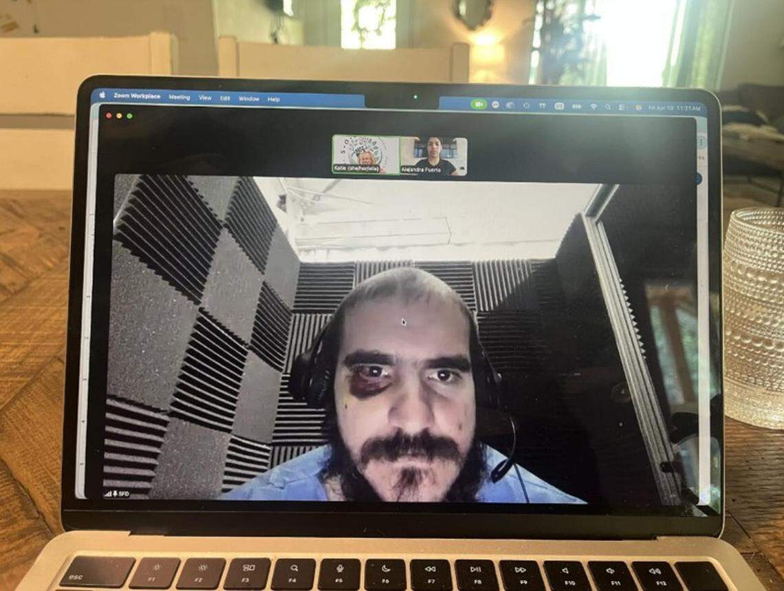 Alligator Alcatraz detainee Raiko Lopez Morffi appeared on an April 10, 2025, video call with his lawyer sporting a black eye from a beating delivered by guards after the immigration detention center’s phones were shut off, causing an uproar, according to a new court filing.