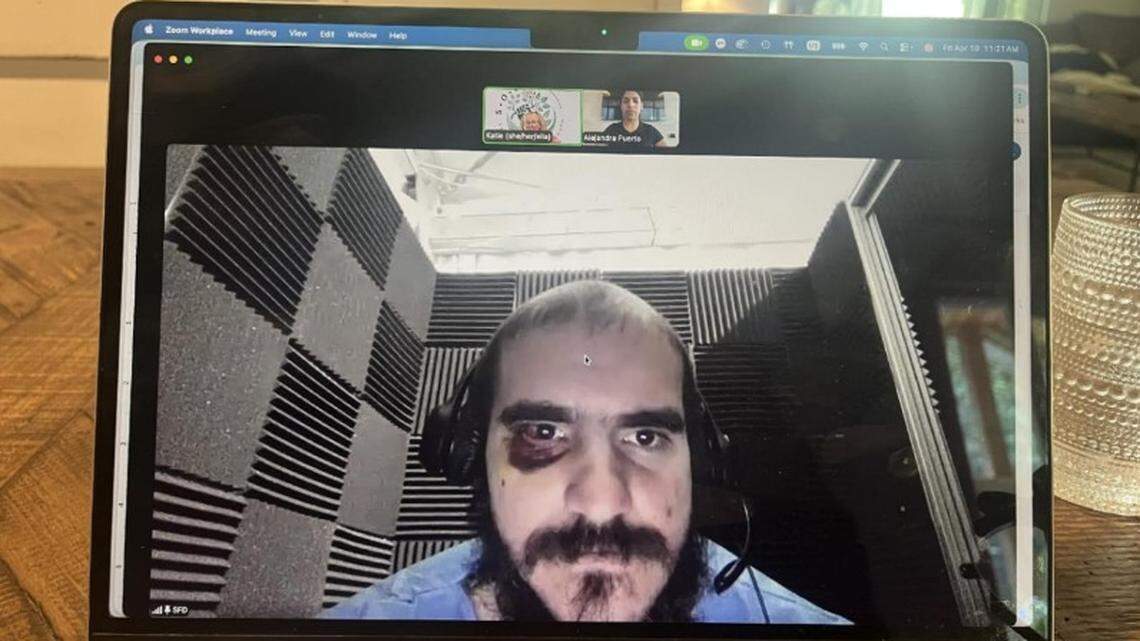 Alligator Alcatraz phones were cut off. Then the beatings began, court docs say