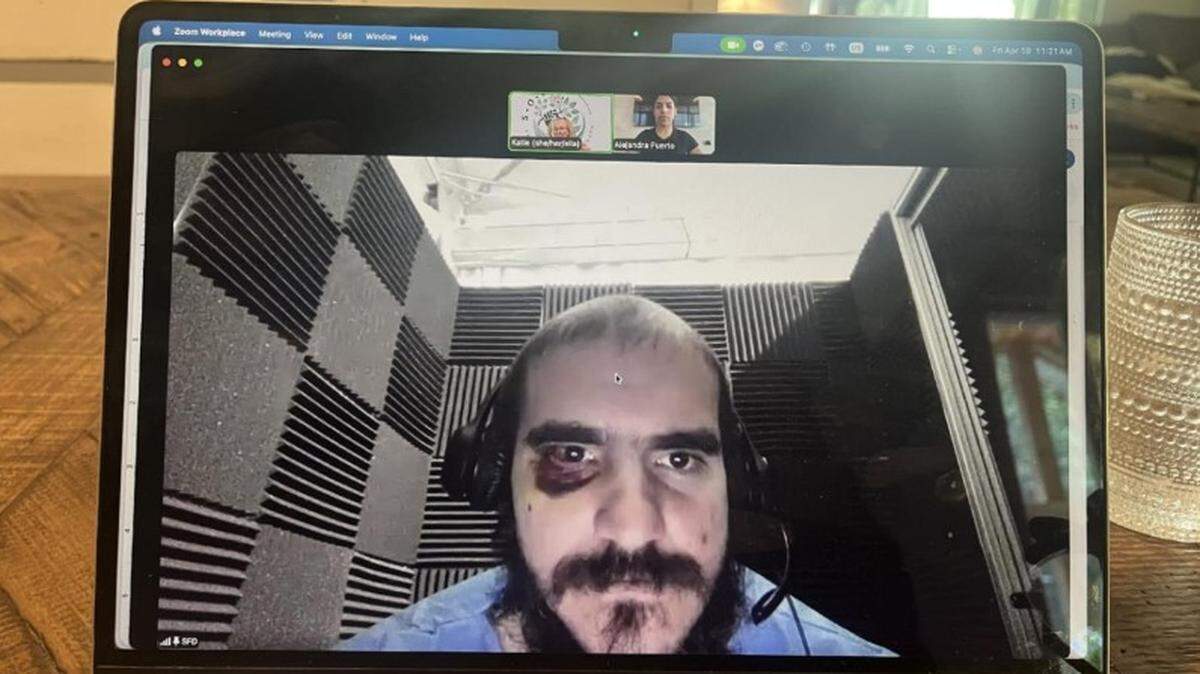 Alligator Alcatraz detainee Raiko Lopez Morffi appeared Friday on a video call with his lawyer sporting a black eye from a beating delivered by guards after the immigration detention center’s phones were shut off, causing an uproar, according to a new court filing.
