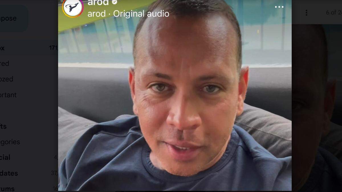 Former Yankee Alex Rodriguez revealed he was recently diagnosed with early-stage gum disease and is getting treatment and raising awareness