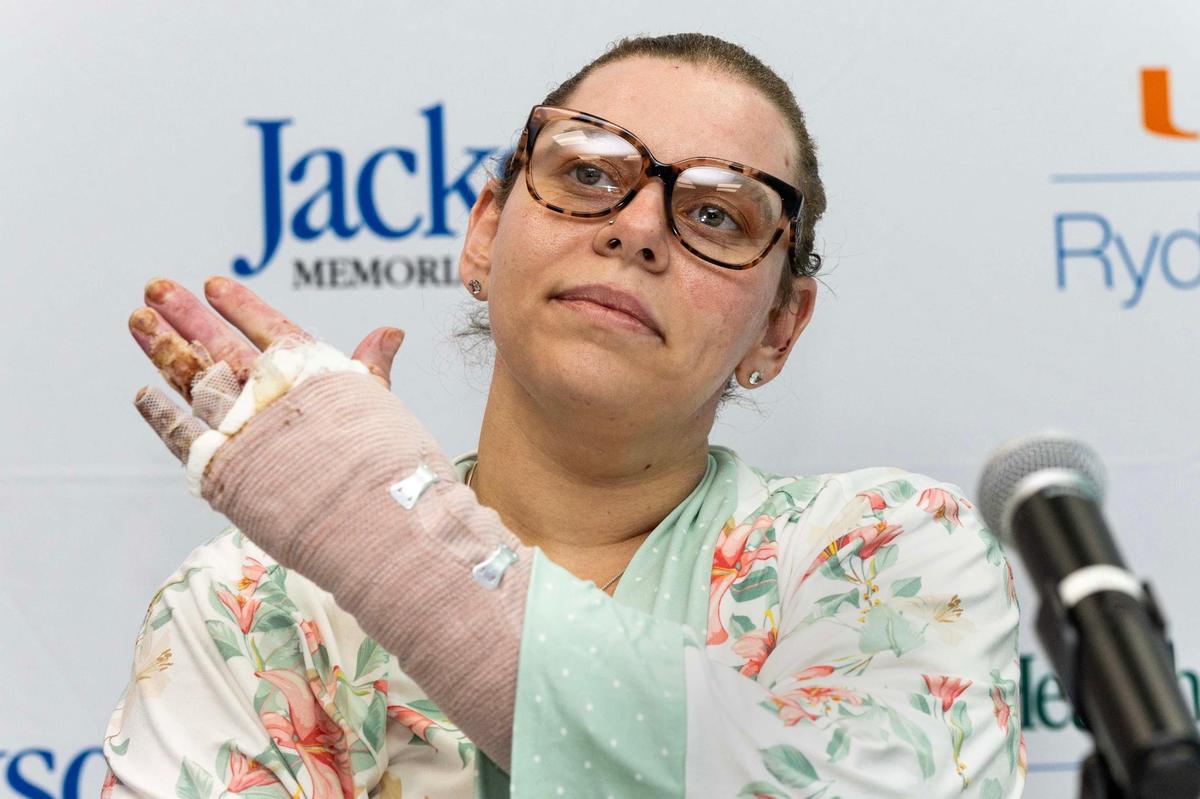 Burn survivor Cassandra Rivera displays the injuries to her left arm as she speaks to the media about the boat explosion off Fort Lauderdale on Memorial Day during a press conference Wednesday,&nbsp;June 11, 2025, at Ryder Trauma Center in Miami .