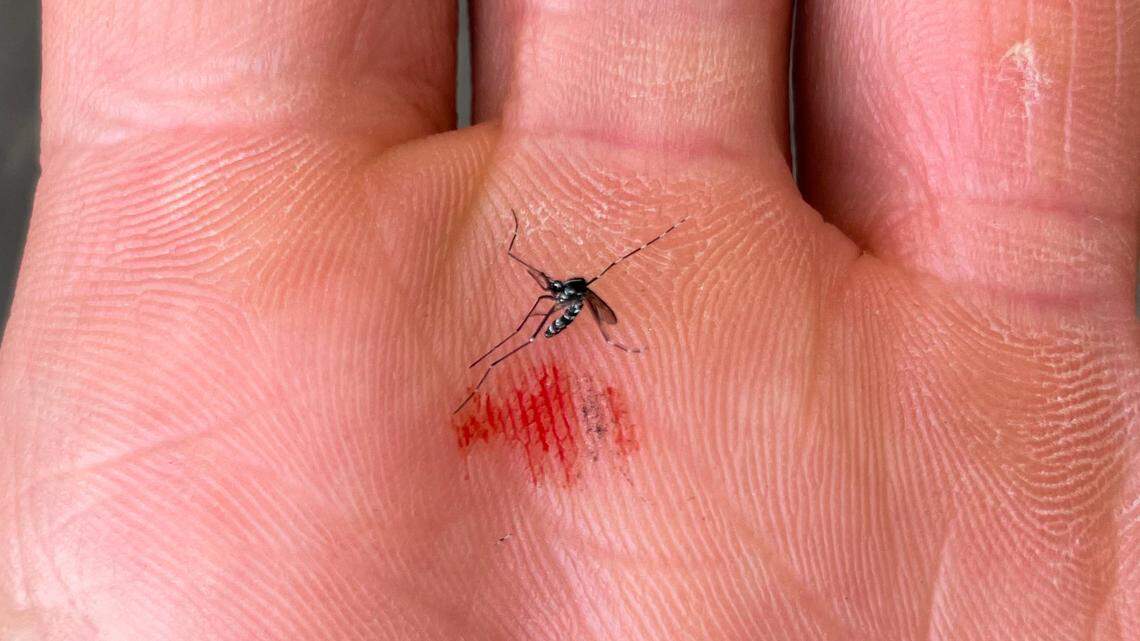 Are You a Mosquito Magnet? The Surprising Reasons Mosquitoes Target Certain People