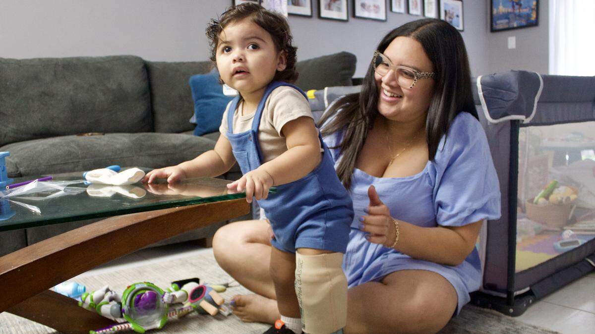 In their Hallandale Beach apartment, Lilchrist McCoy Alcantara helps her son, Bryson Guiterrez, stand using his prosthesis.