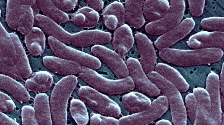 Rare, deadly bacteria found in SC coastal waters. Here’s what we know